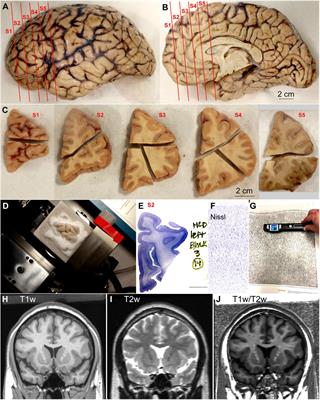 A Protocol for Cortical Type Analysis of the Human Neocortex Applied on Histological Samples, the Atlas of Von Economo and Koskinas, and Magnetic Resonance Imaging
